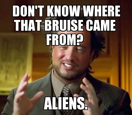Don't know where those bruises came from? Aliens.
